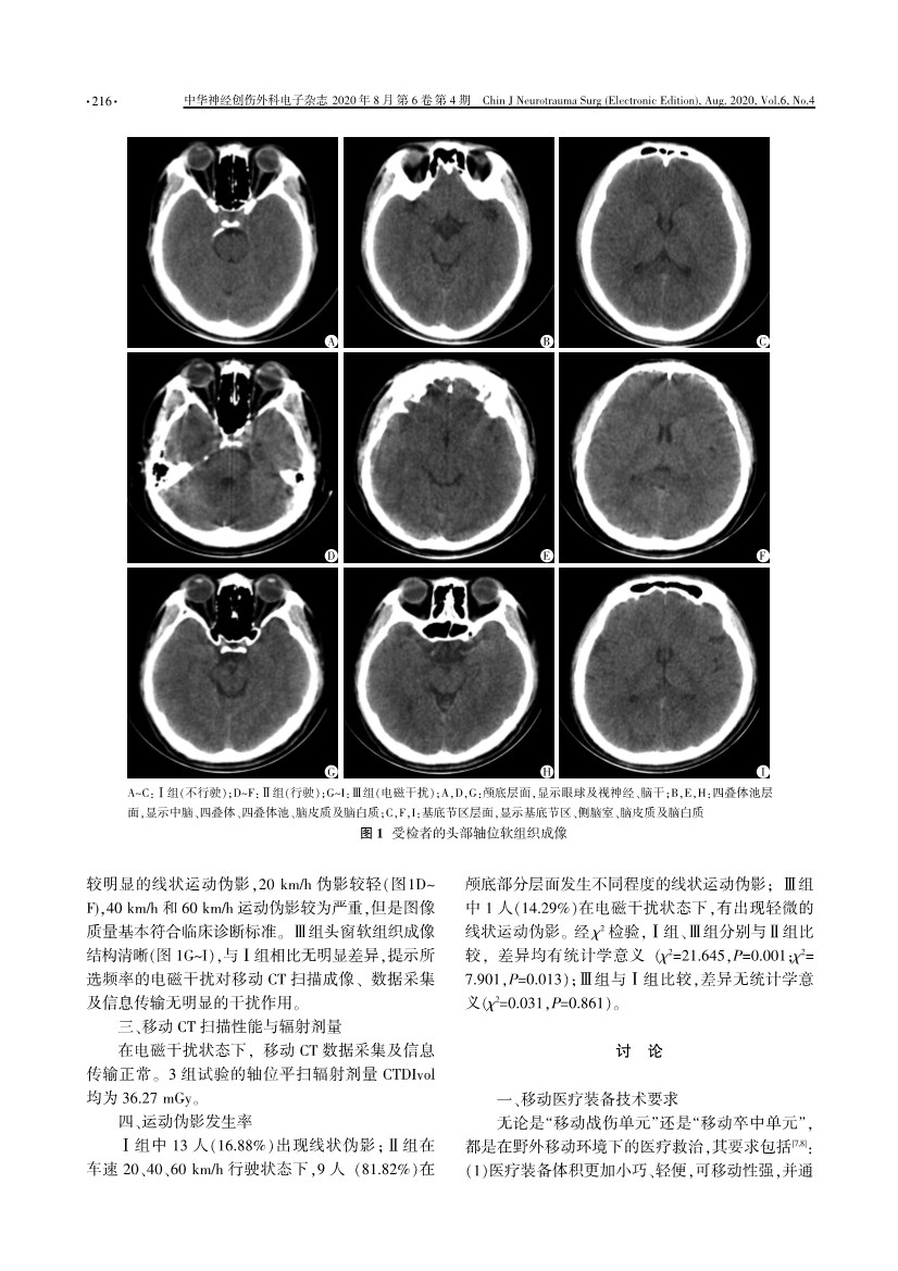 学术交流：“移动战伤单元”16排移动CT头部扫描试验报告